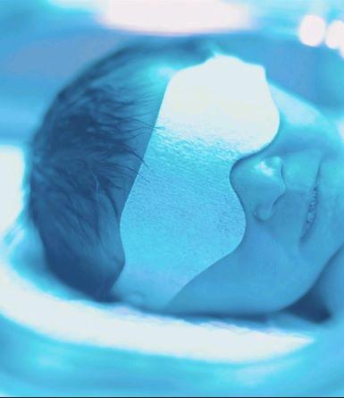 NICU